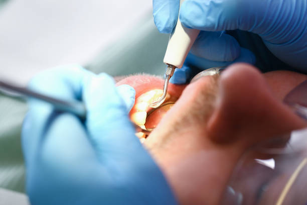 Best Emergency Dental Services for Seniors in Crooks, SD