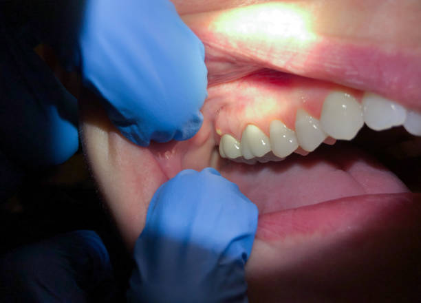 Best Emergency Cosmetic Dentistry in Crooks, SD